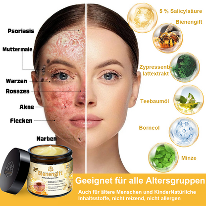 [Zusätzliche 30 % Rabatt] TLOPA® Fortgeschrittene Bienengift Behandlungscreme  (🔥Letzter Tag Aktion 80% Rabatt)