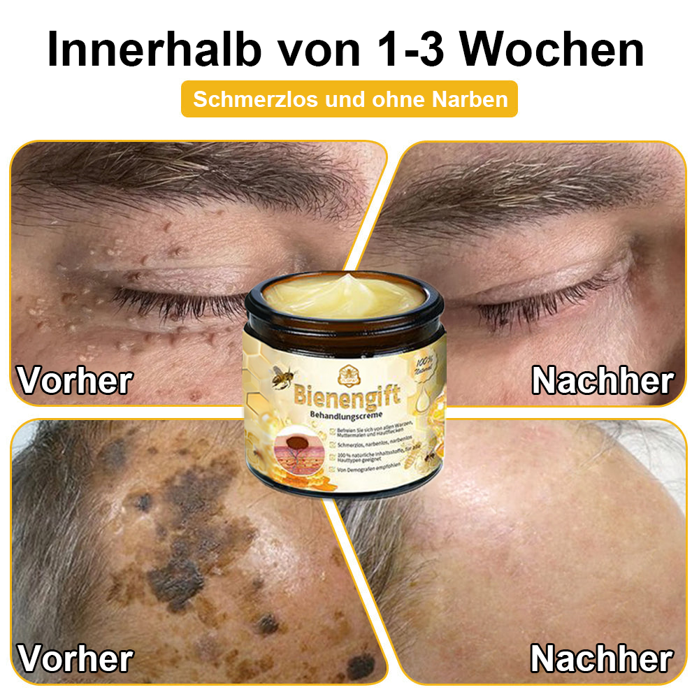 [Zusätzliche 30 % Rabatt] TLOPA® Fortgeschrittene Bienengift Behandlungscreme  (🔥Letzter Tag Aktion 80% Rabatt)