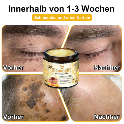 [Zusätzliche 30 % Rabatt] TLOPA® Fortgeschrittene Bienengift Behandlungscreme  (🔥Letzter Tag Aktion 80% Rabatt)