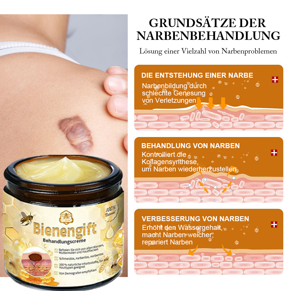 [Zusätzliche 30 % Rabatt] TLOPA® Fortgeschrittene Bienengift Behandlungscreme  (🔥Letzter Tag Aktion 80% Rabatt)