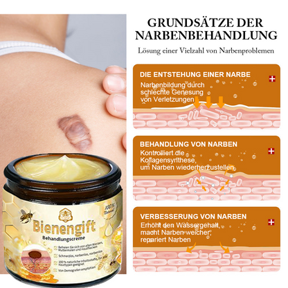 [Zusätzliche 30 % Rabatt] TLOPA® Fortgeschrittene Bienengift Behandlungscreme  (🔥Letzter Tag Aktion 80% Rabatt)
