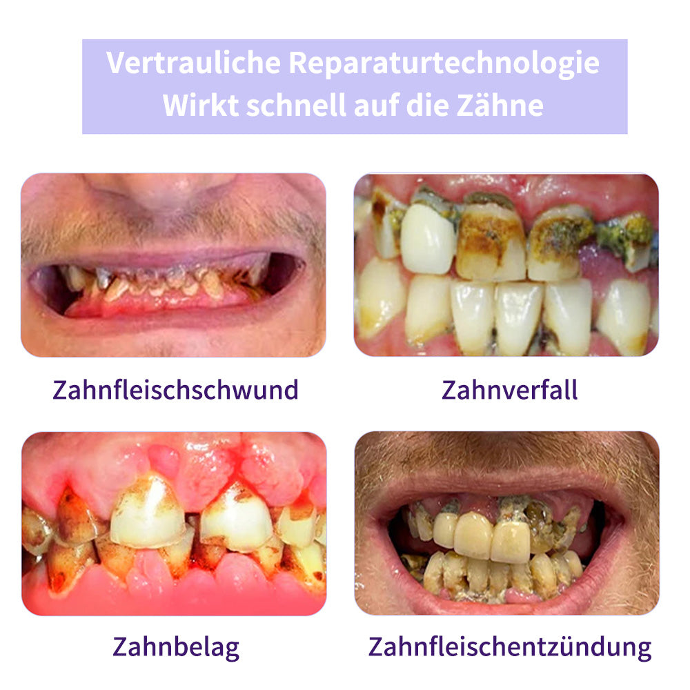 Zahnreparatur-Mineralpuder💧Cvreoz®(Empfohlen von der EAD)Zusätzliche 30 % Rabatt
