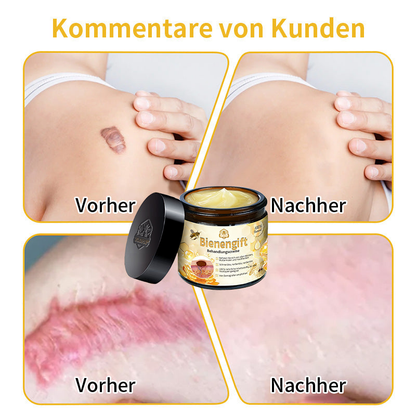 [Zusätzliche 30 % Rabatt] TLOPA® Fortgeschrittene Bienengift Behandlungscreme  (🔥Letzter Tag Aktion 80% Rabatt)