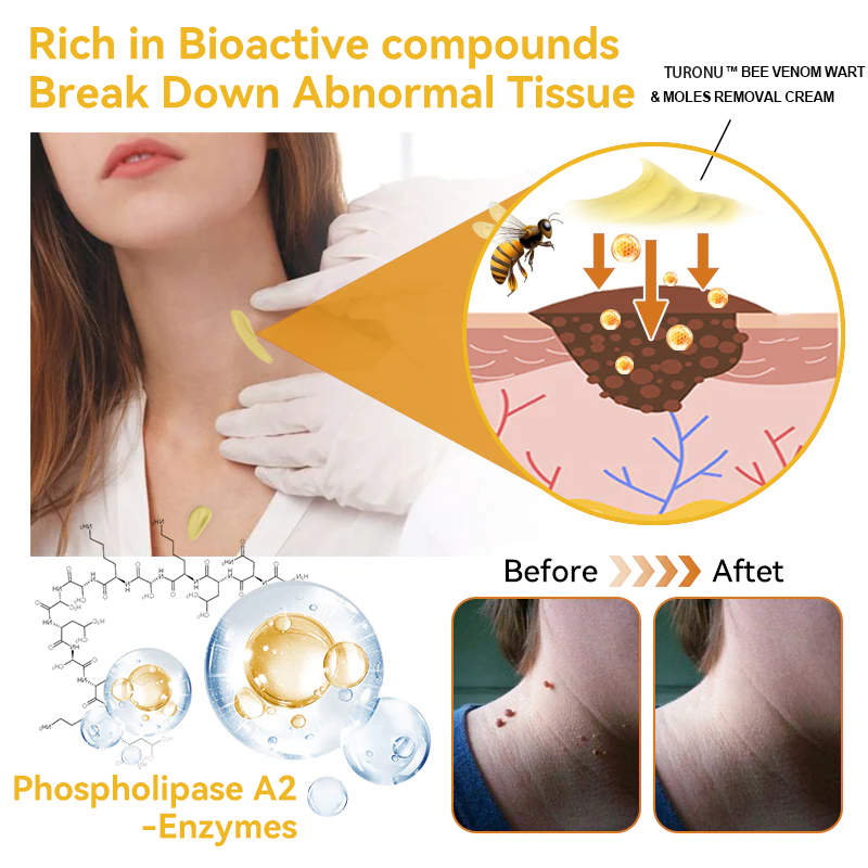 [Zusätzliche 30 % Rabatt] TLOPA® Fortgeschrittene Bienengift Behandlungscreme  (🔥Letzter Tag Aktion 80% Rabatt)