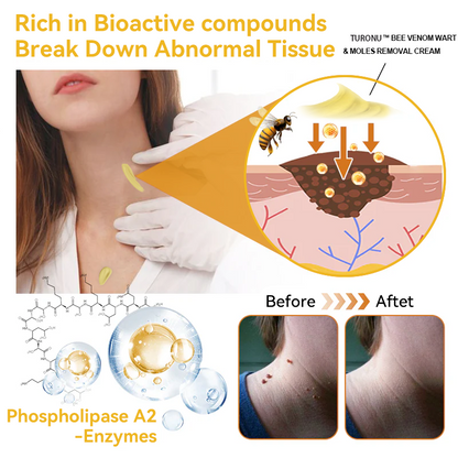 [Zusätzliche 30 % Rabatt] TLOPA® Fortgeschrittene Bienengift Behandlungscreme  (🔥Letzter Tag Aktion 80% Rabatt)