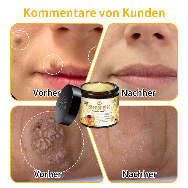 [Zusätzliche 30 % Rabatt] TLOPA® Fortgeschrittene Bienengift Behandlungscreme  (🔥Letzter Tag Aktion 80% Rabatt)