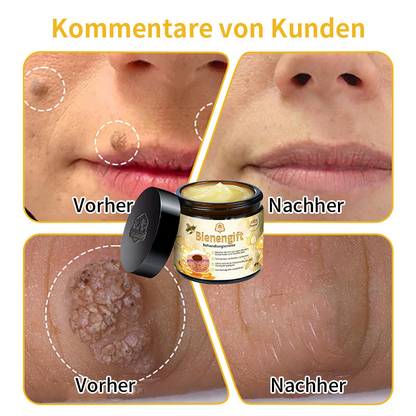 [Zusätzliche 30 % Rabatt] TLOPA® Fortgeschrittene Bienengift Behandlungscreme  (🔥Letzter Tag Aktion 80% Rabatt)