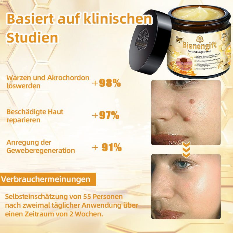 [Zusätzliche 30 % Rabatt] TLOPA® Fortgeschrittene Bienengift Behandlungscreme  (🔥Letzter Tag Aktion 80% Rabatt)