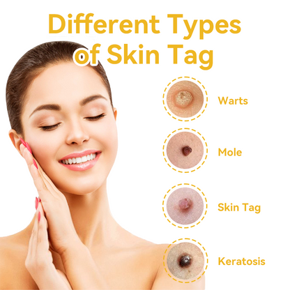 [Zusätzliche 30 % Rabatt] TLOPA® Fortgeschrittene Bienengift Behandlungscreme  (🔥Letzter Tag Aktion 80% Rabatt)