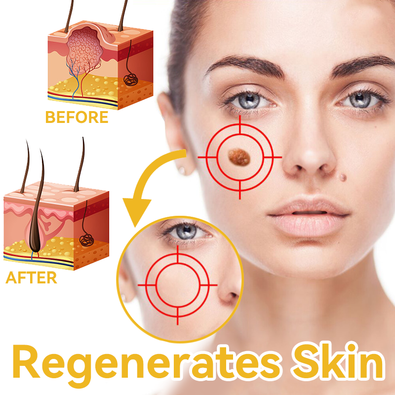 [Zusätzliche 30 % Rabatt] TLOPA® Fortgeschrittene Bienengift Behandlungscreme  (🔥Letzter Tag Aktion 80% Rabatt)